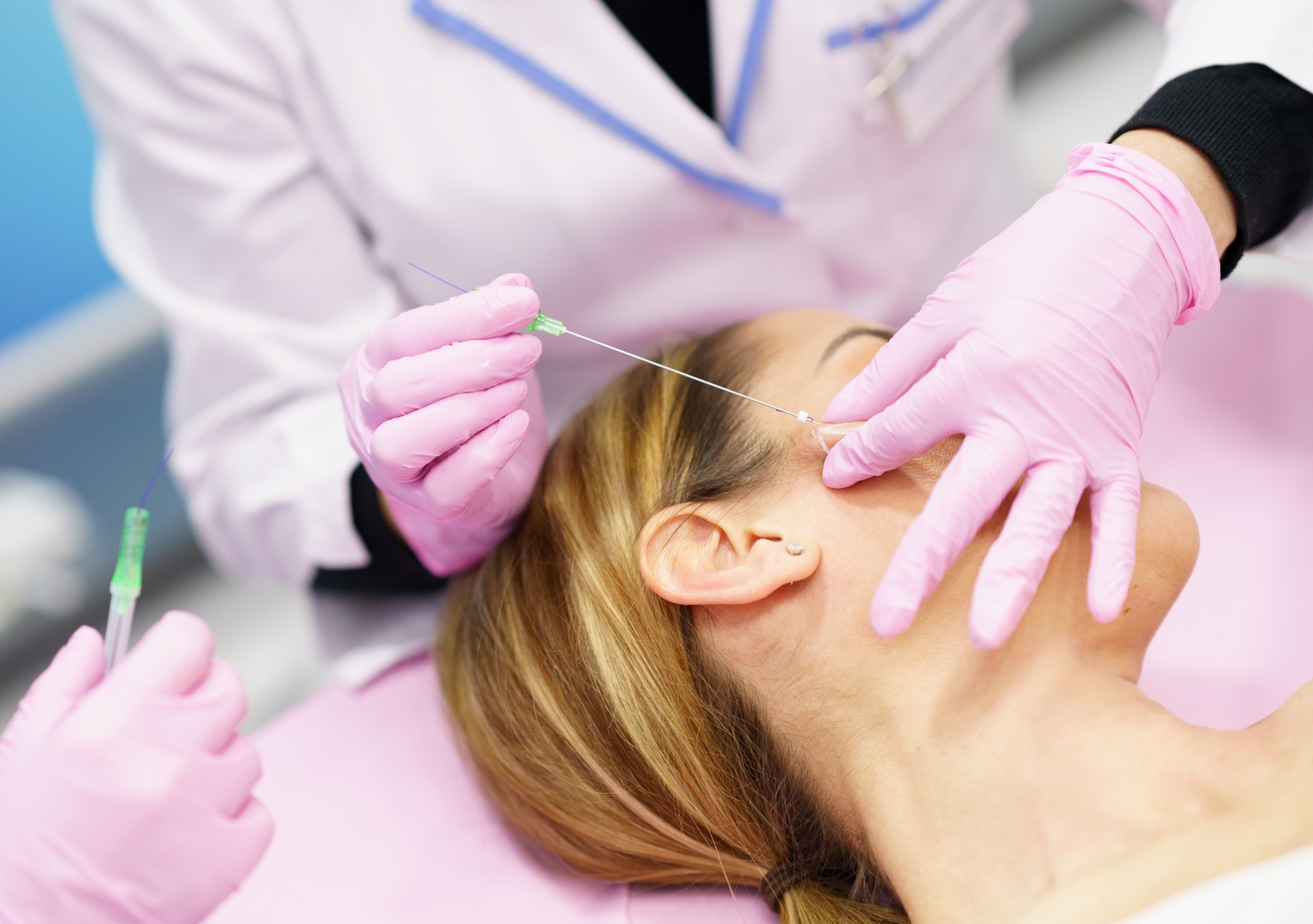 Polydioxanone (PDO) Threads: A Comprehensive Guide - zevanex.ae